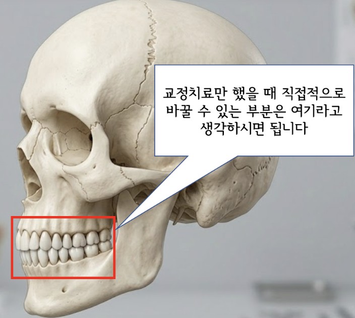 교정치료로 직접 개선 가능한 범위를 표시한 두개골 그림